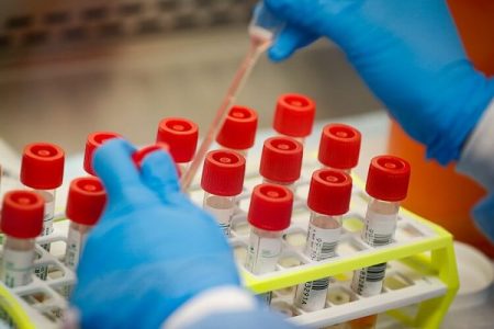 NA VIRUS KORONA POZITIVNO ŠEST OSOBA U JABLANIČKOM OKRUGU